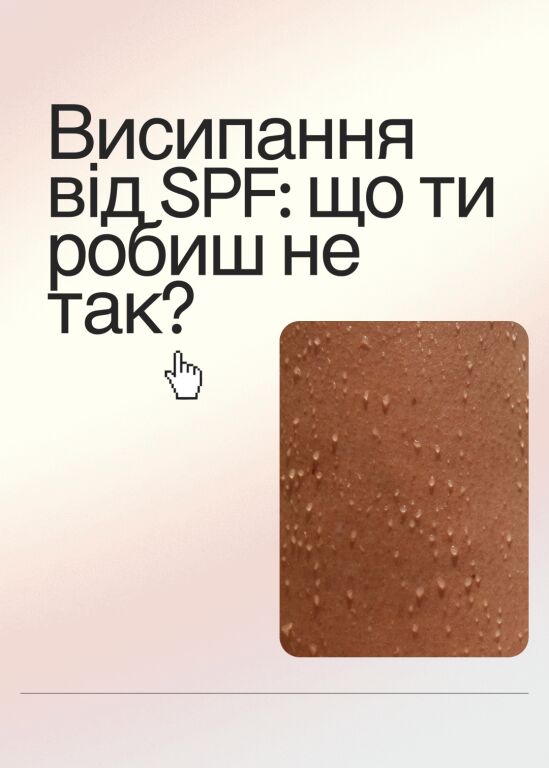 Висипання від SPF-засобів