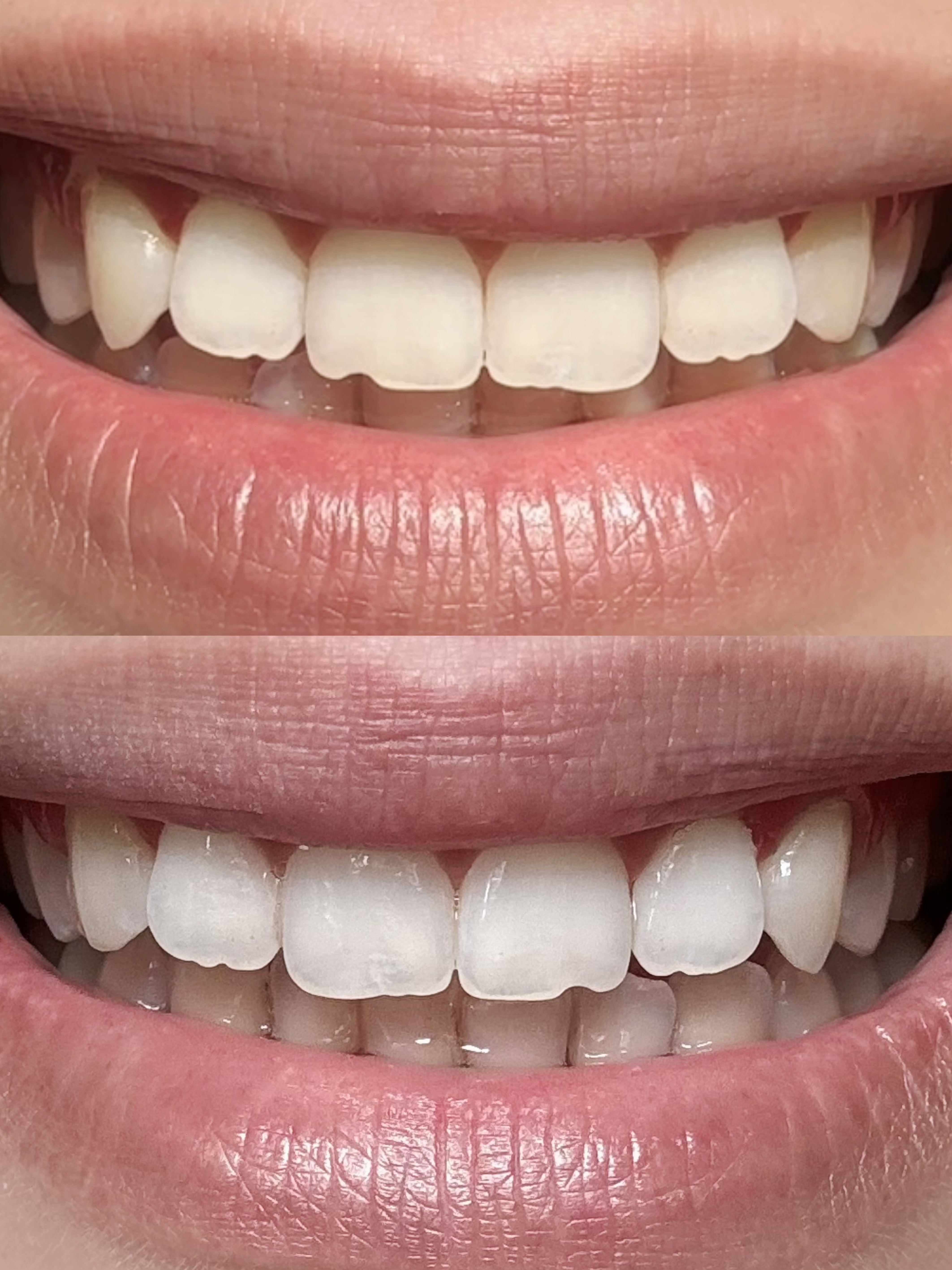 Здорова білизна зубів