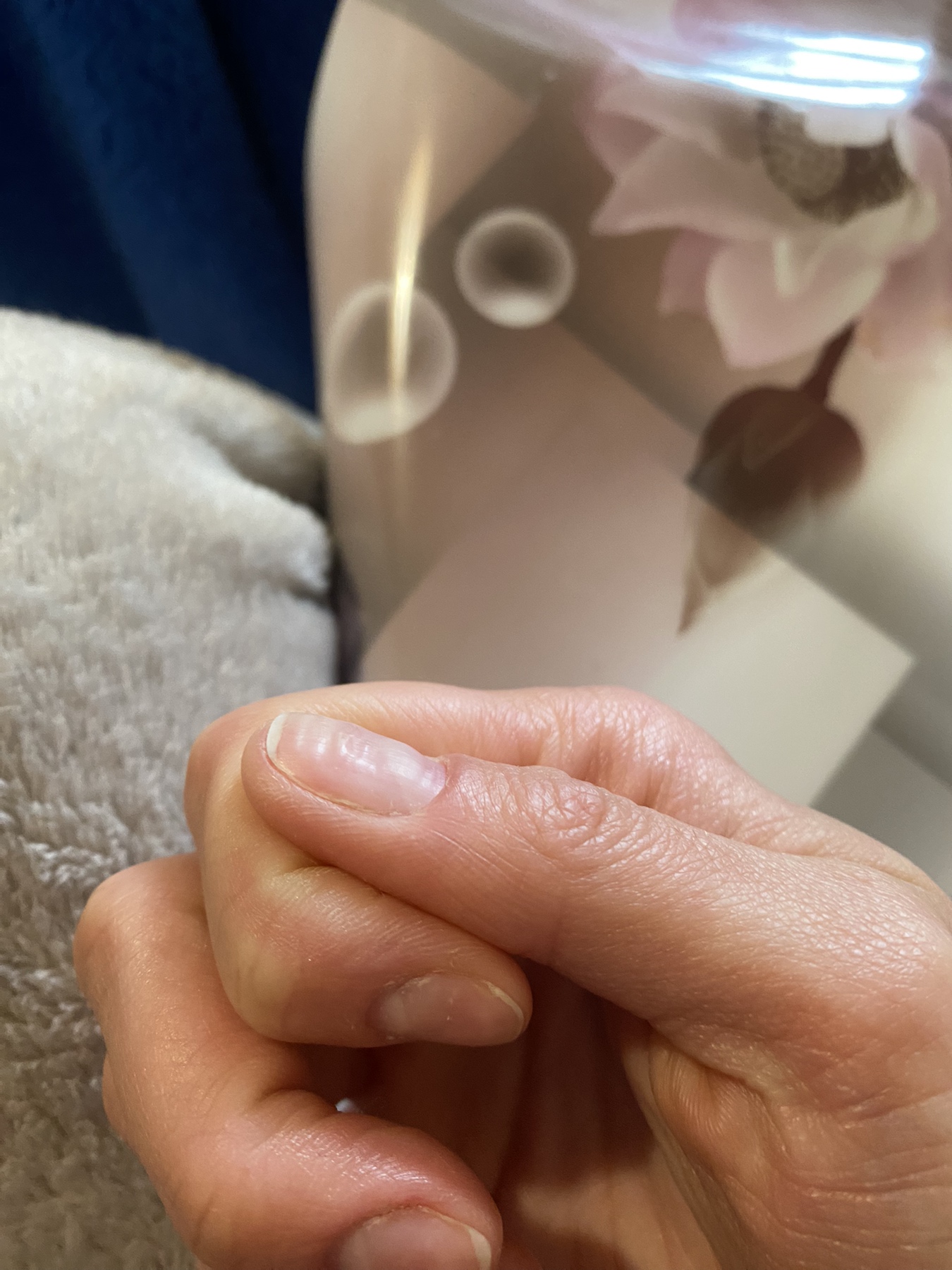 відновлення нігтів після гель лаку