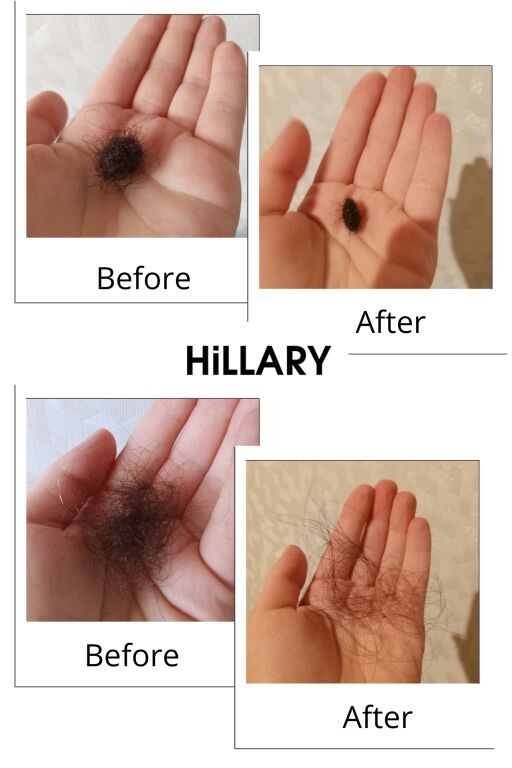 Шампунь проти випадання волосся Hillary Serenoa Vitamin Рр Hair Loss Control