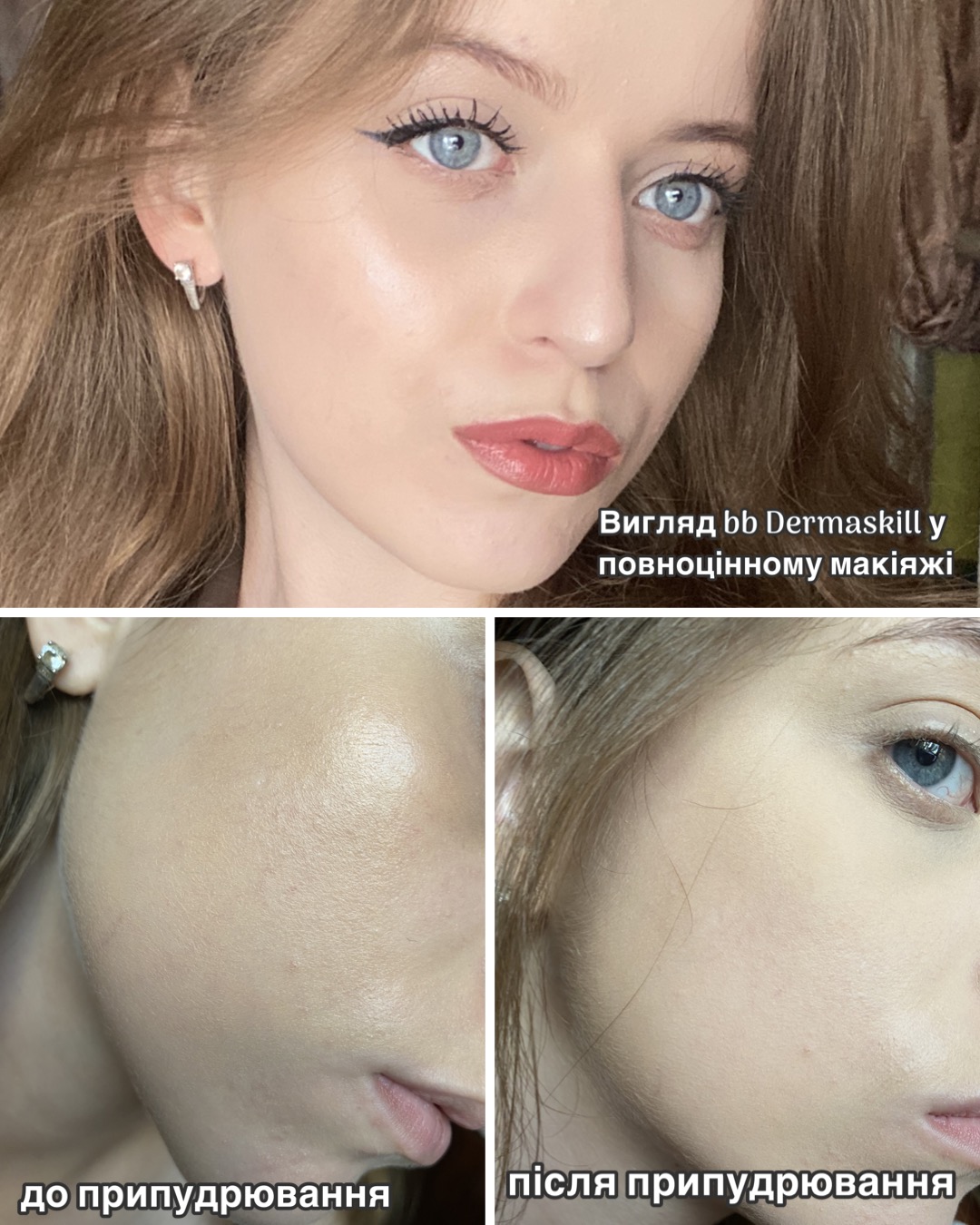 Претендент на найкращий ВВ літа 2024? | Dermaskill Bb Smart Cream SPF30