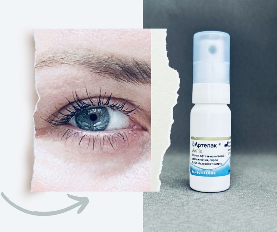 Artelac EyeLid: вам варто про нь�ого знати