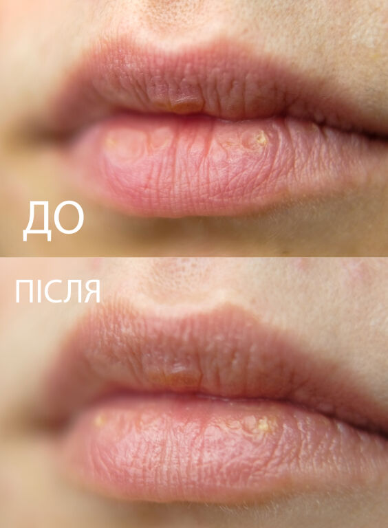 Ласощі для ва�ших губ : Mixtura Lip Balm Citrus