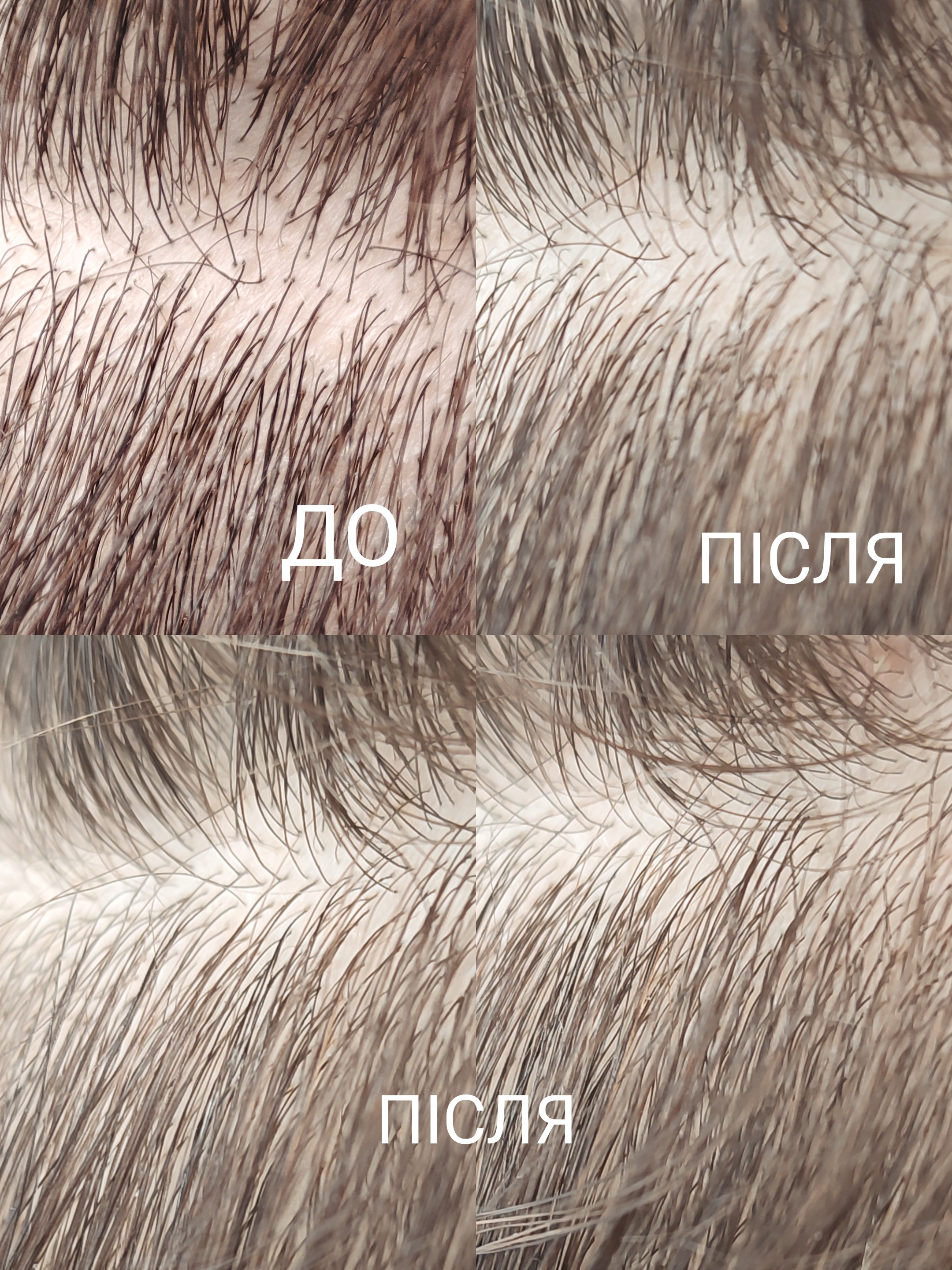 Призначення,дія та результат|Balea Scalp Peeling