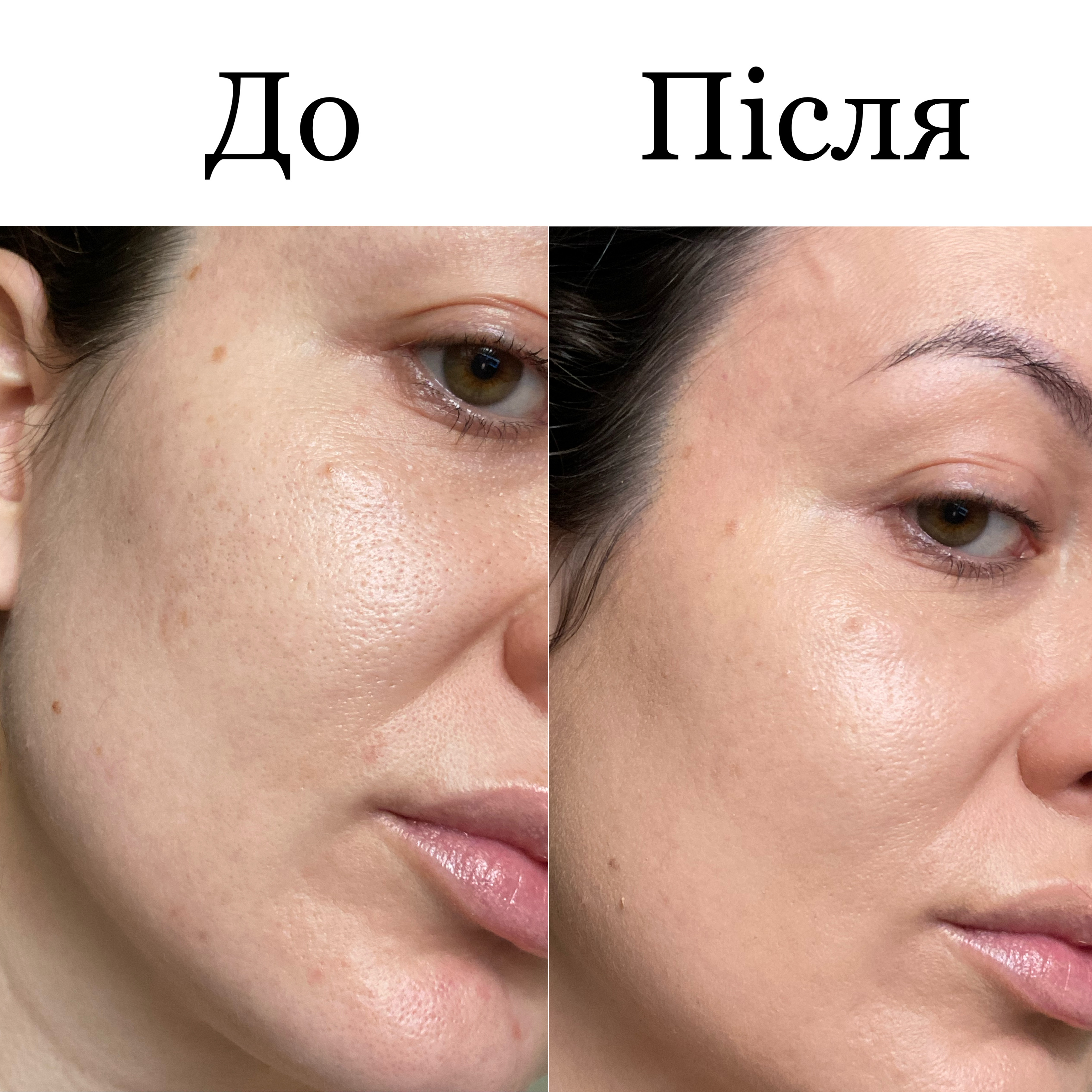 Ще один класний тон) L`Oréal Paris BB Magic