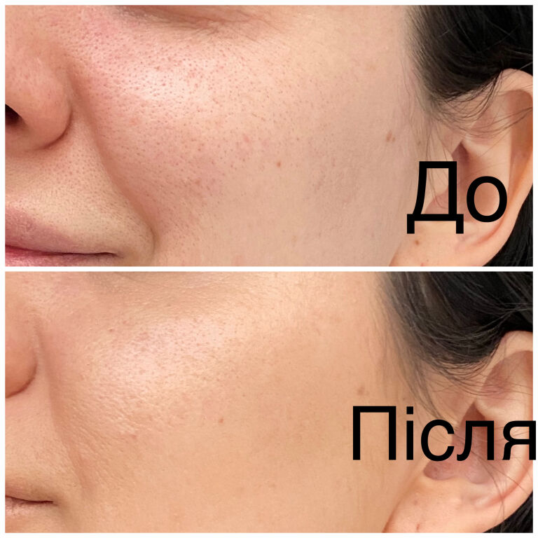 Один з найкращих тонів! Dior Forever Skin Glow