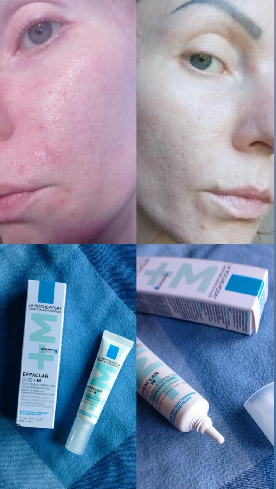 La Roche-Posay Effaclar Duo + M