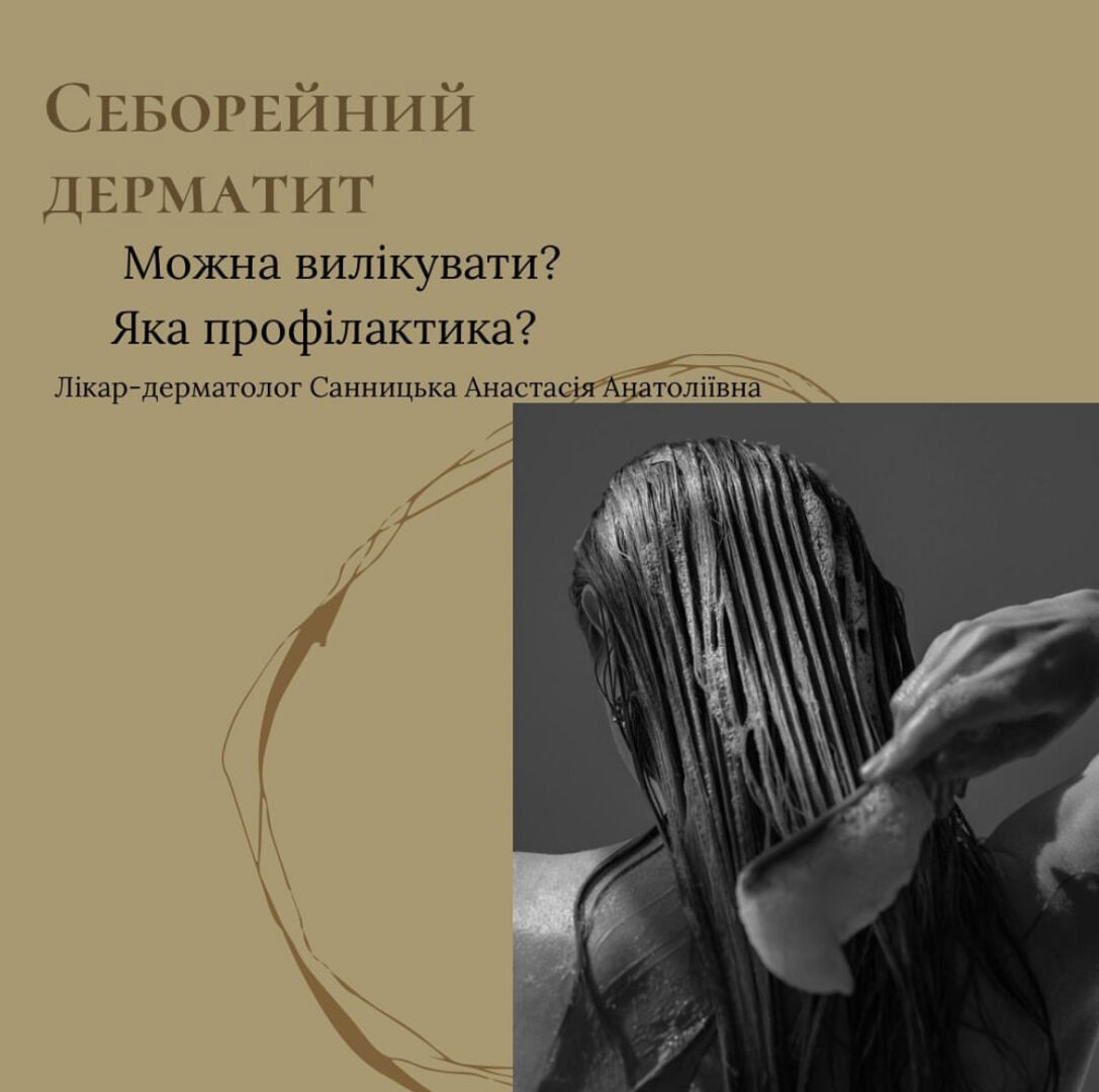 Топ 5 запитань лікарю-трихологу щодо профілактики себорейного дерматиту