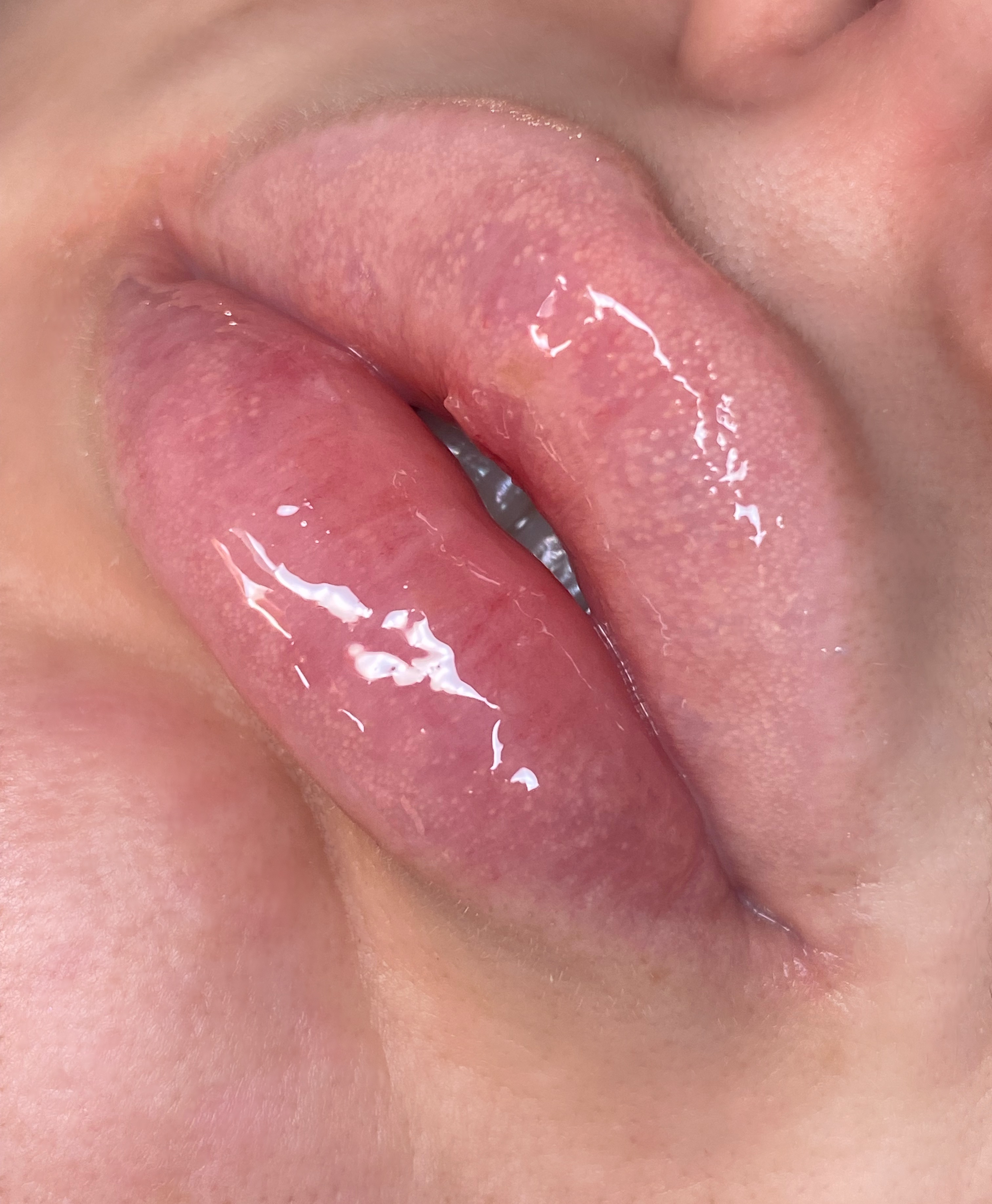 Чому сохнуть губи і як рятуватись?