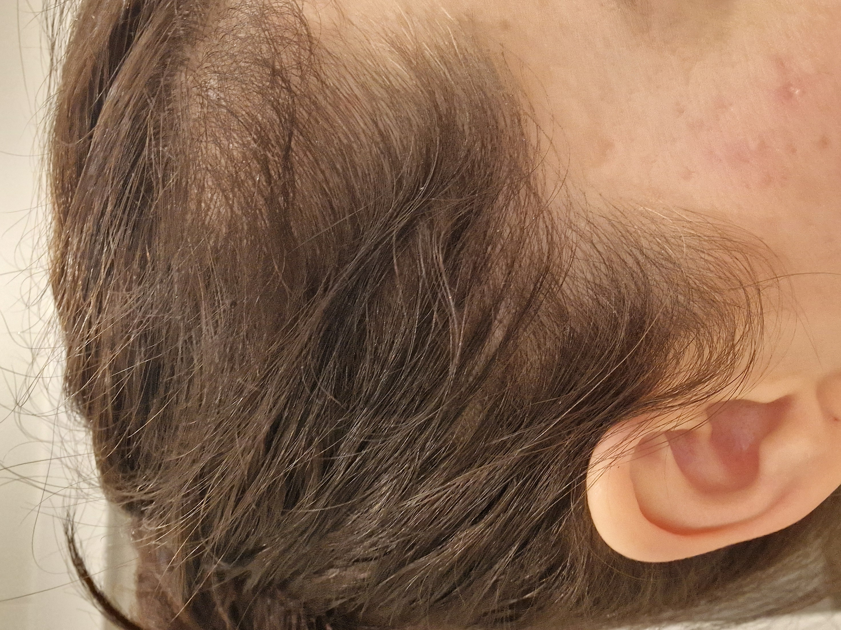 Відновити втрачене волосся, ч.1 (+ фото результатів)