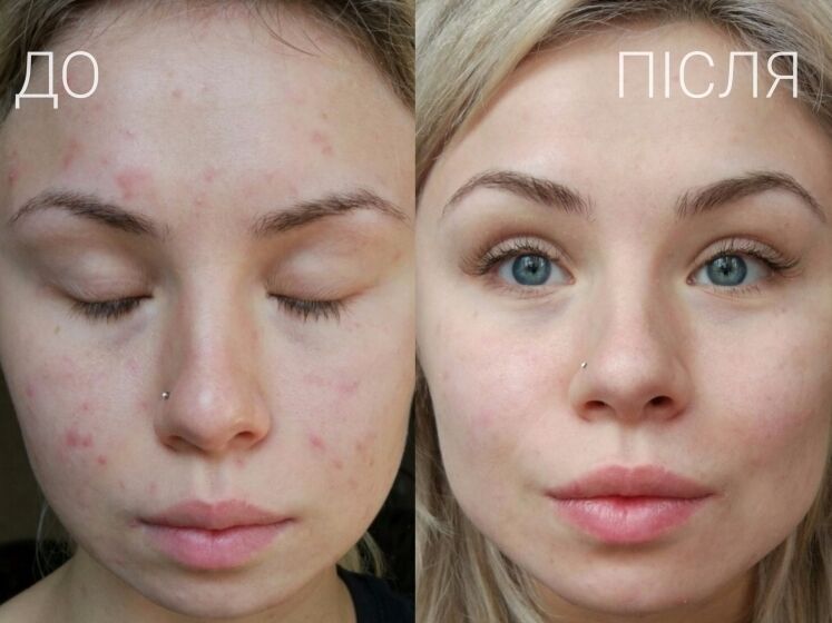 Гелі для вмивання Effaclar від La Roche-Posay: Думки після 6 років знайомства