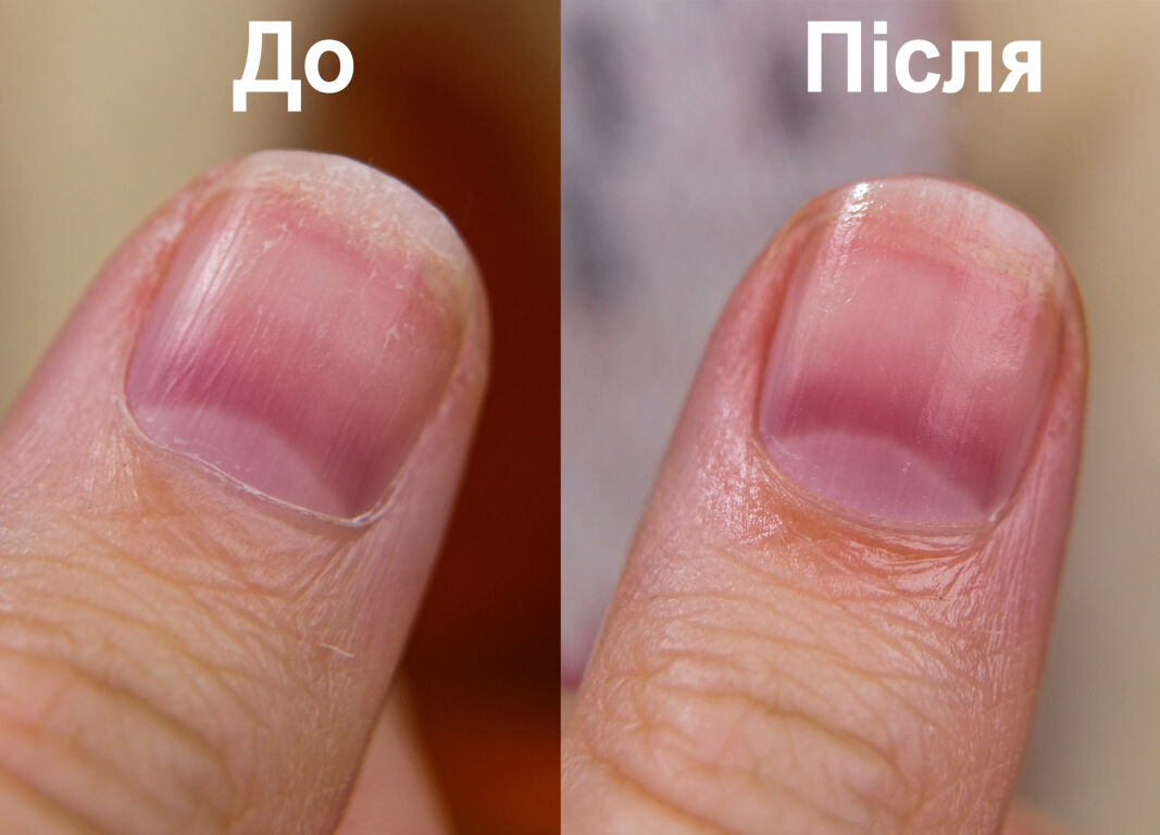 Shelly Nail & Cuticle Oil Apple & Cinnamon : ще одна олійка, яка буде турбуватися про мою кутикулу