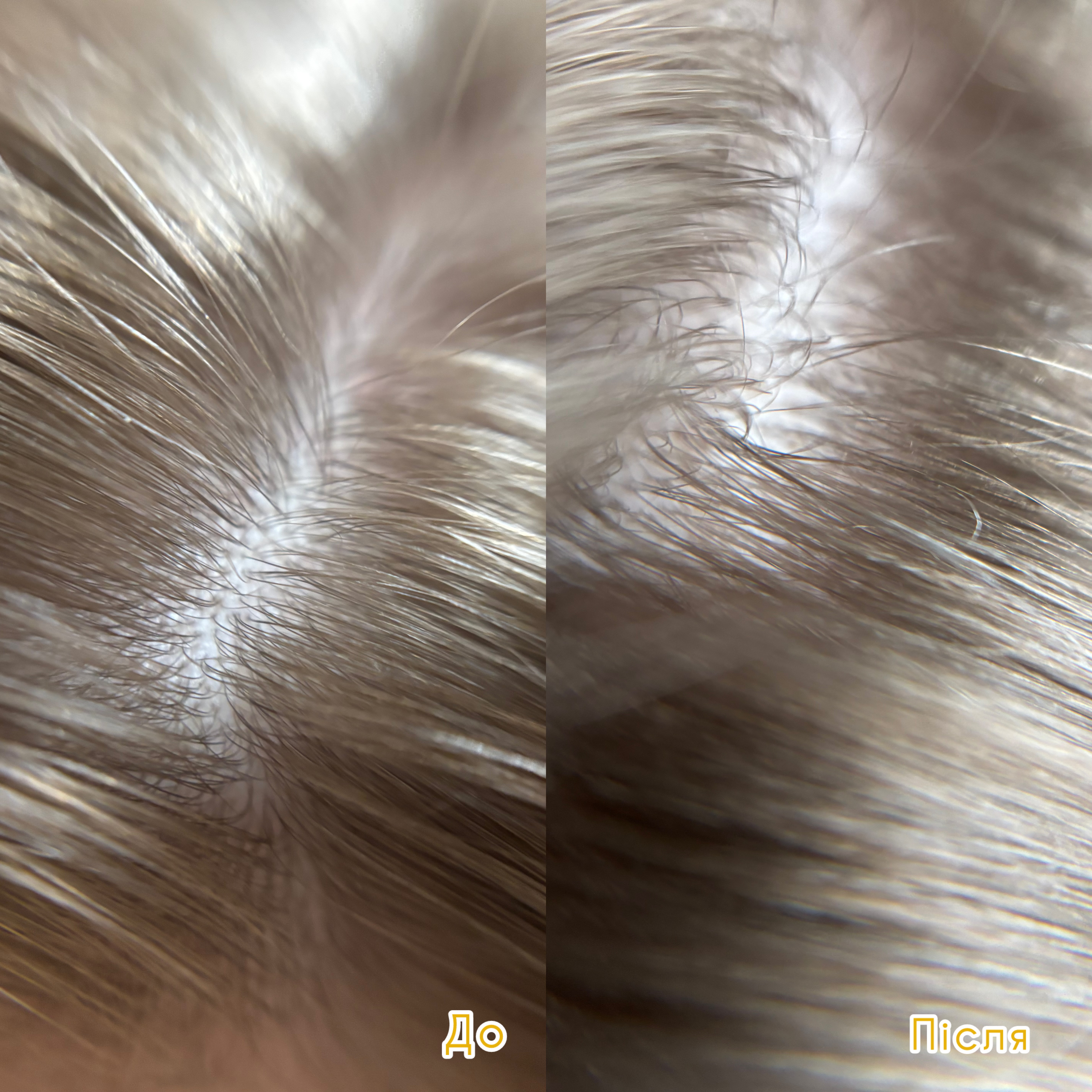 Acid Scalp Peeling | Joko Blend